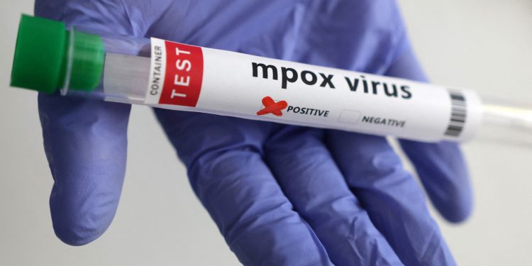 نيجيريا تبدأ توفير لقاح جدري القرود أكتوبر القادم